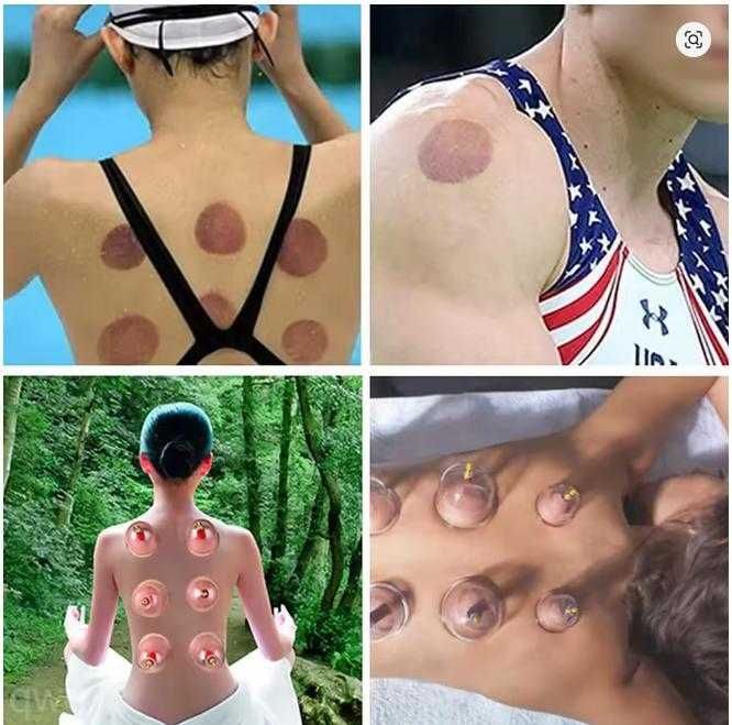 Банки вакуумні пластикові хіджама массажные банки вакуум терапия