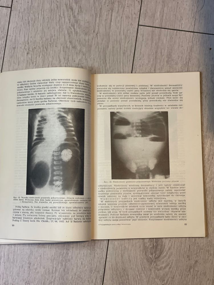 Fizjologia Noworodka i Wcześniaka 1964 Jerzykowska-Kuleszyna PZWL