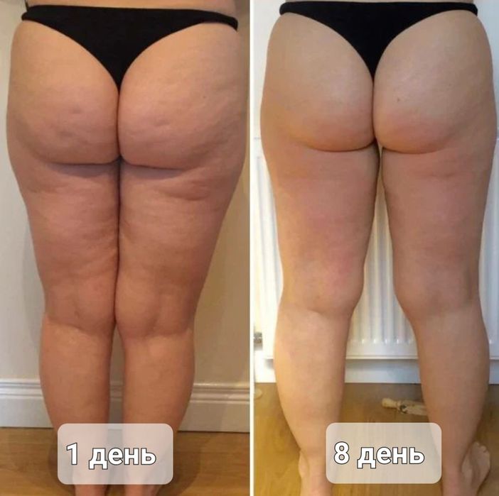 Професійний дієвий масаж на дому.