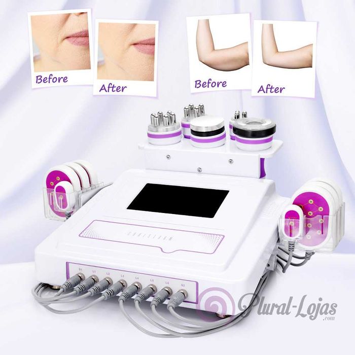 Maquina 6 em 1 de Cavitação + Radiofrequencia + Vácuo + LipoLaser