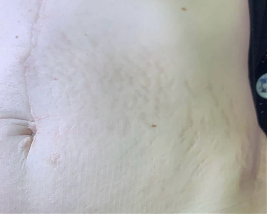 мікронідлінг з 0 до прфі курси