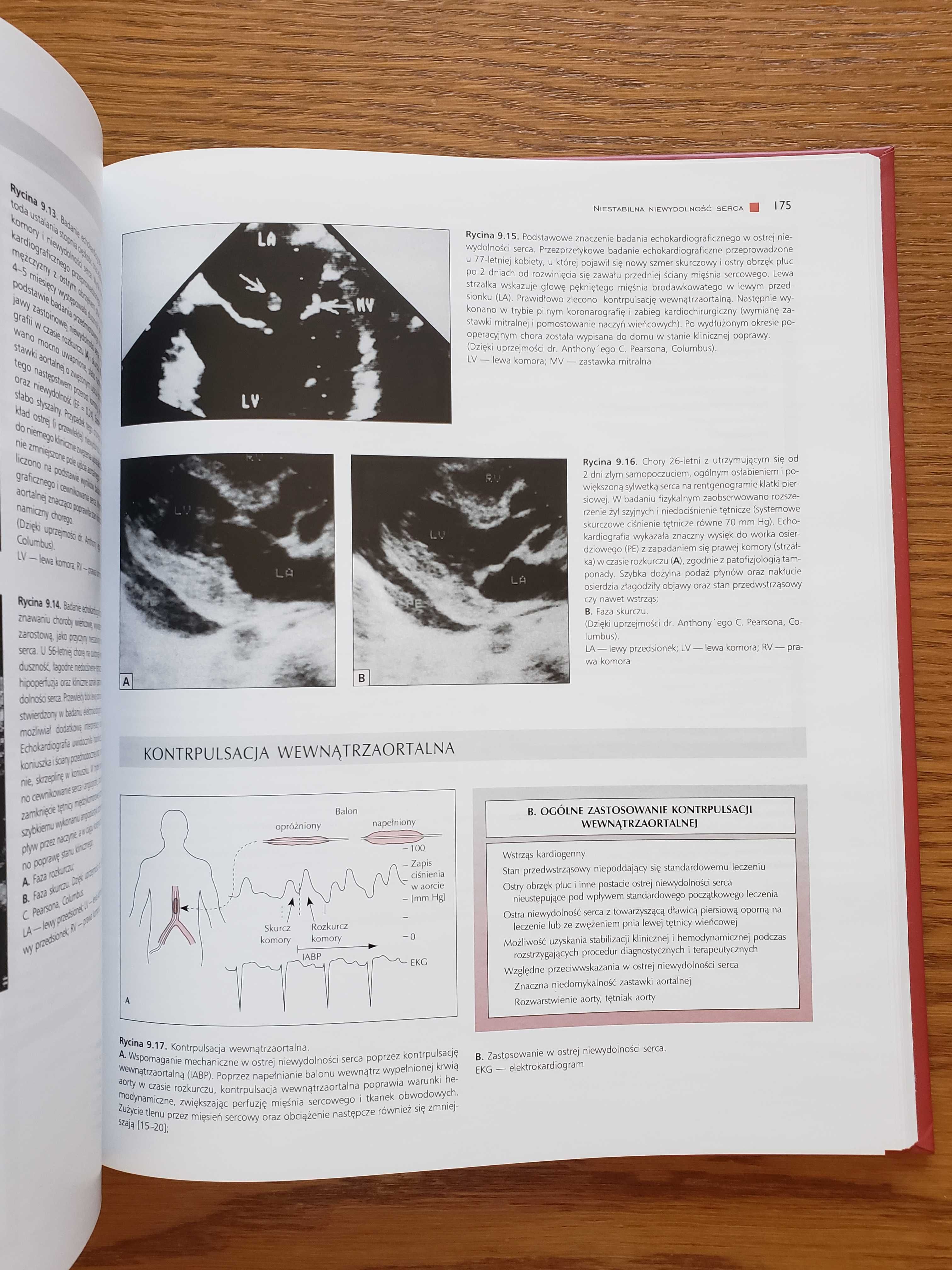 Atlas niewydolności serca pod red. W. Colucciego i E. Braunwalda