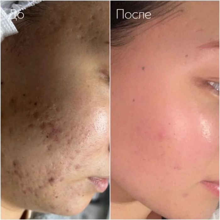 Косметолог,досвід  11 років.