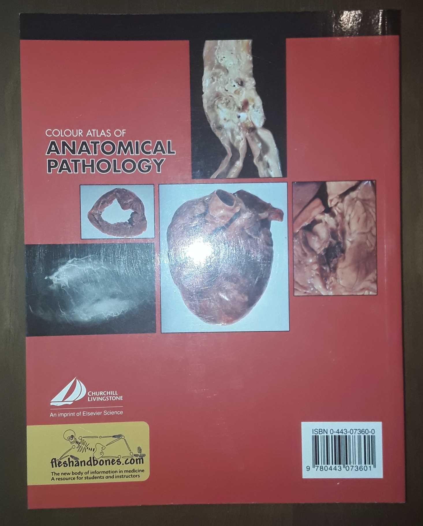 Color Atlas of Anatomical Pathology 3rd edition Cooke