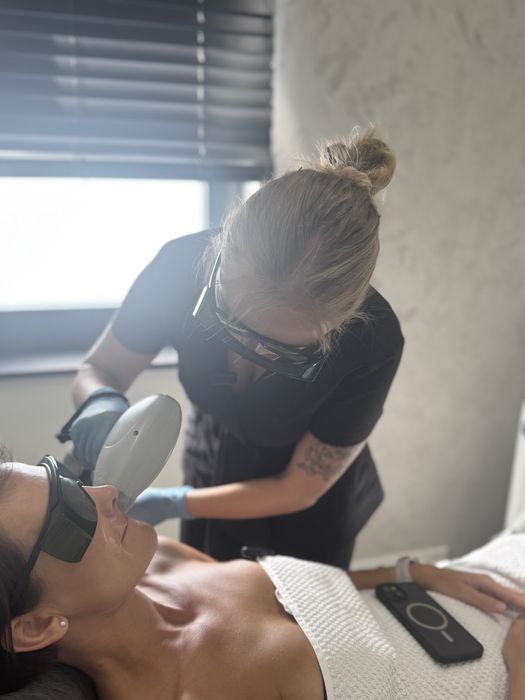 Laser do depilacji Primelease wynajem