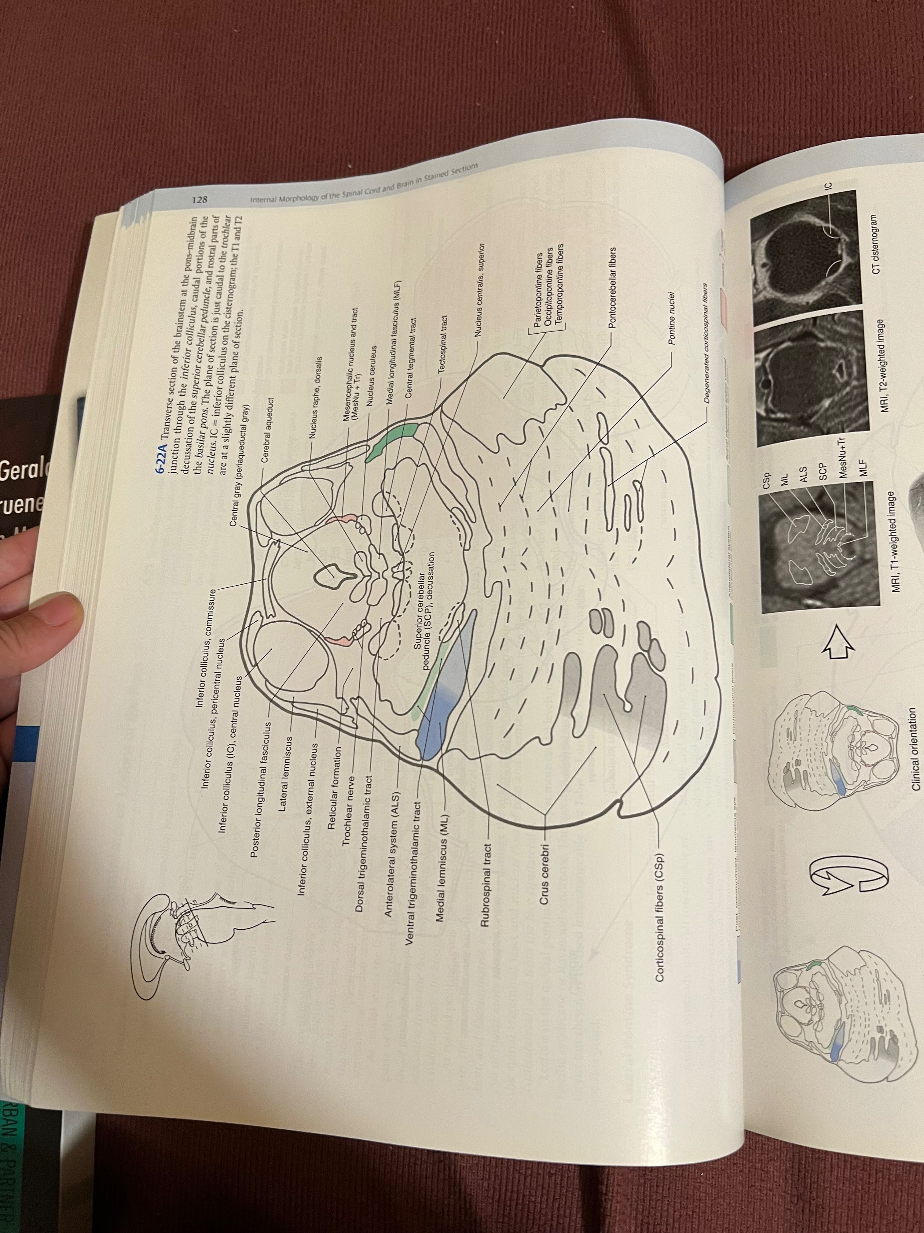 Neuroanatomy Atlas Haines