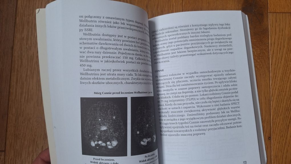 Leczenie lęków i depresji Daniel G. Amen, Lisa C. Routh książka
