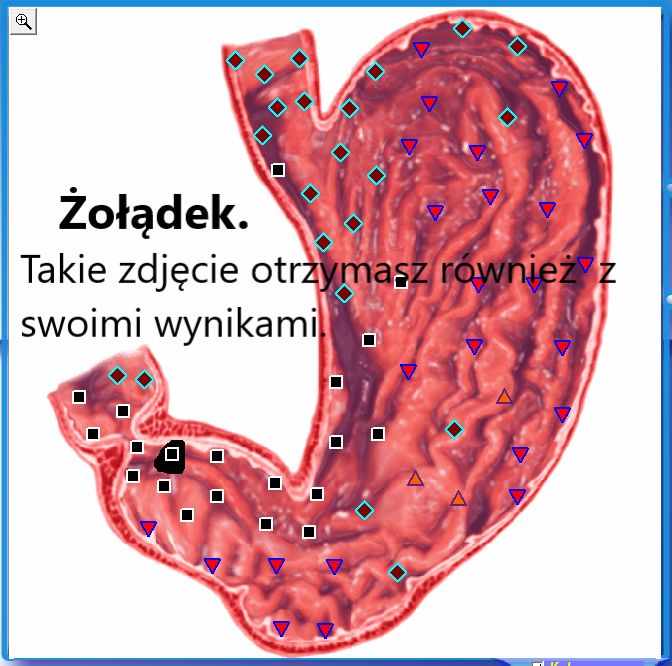 Wykrywanie i Usuwanie-Bakterii, Pasożytów, Grzybic-NEOMED Śląsk