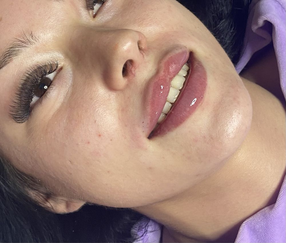 Powiększanie ust na płasko 1ml350zł,2ml450zł,botox,niciPDO4D,lipoliza,
