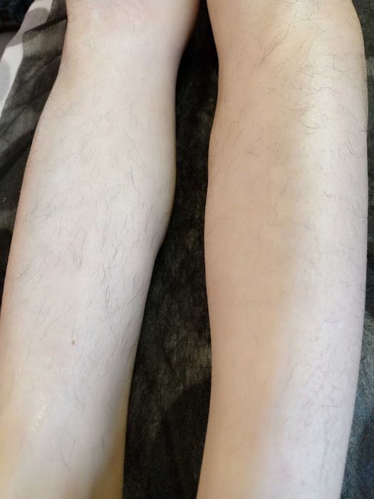 Воскова депіляція/Мікронідлінг/Мезотерапія/Вакуумно-роликовий масаж