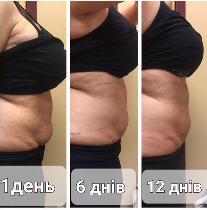 Професійний дієвий масаж на дому.