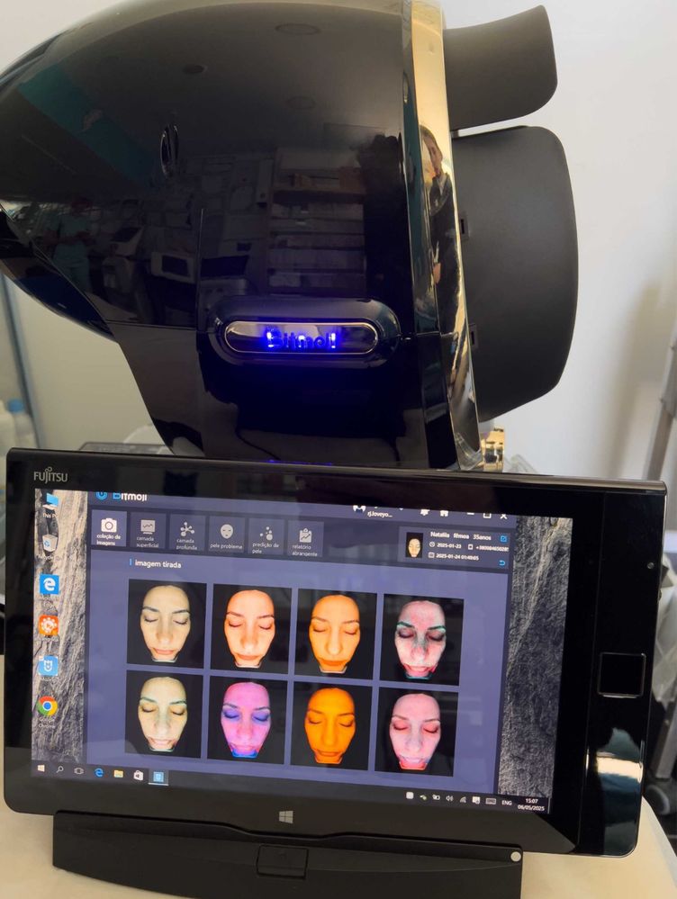 3D scanner de pele analisador facial com monitor
