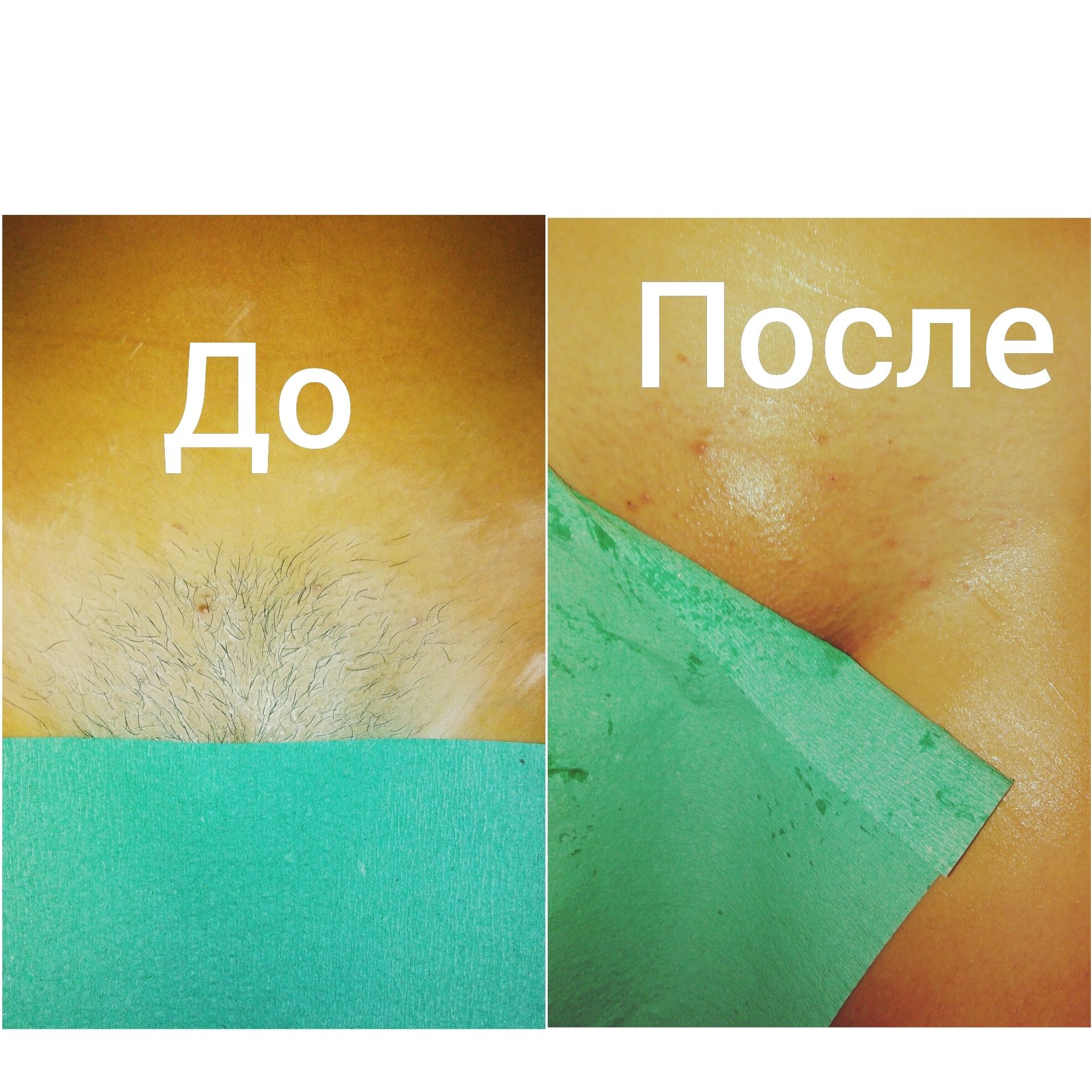 Акция!!! Шугаринг, Восковая депиляция
