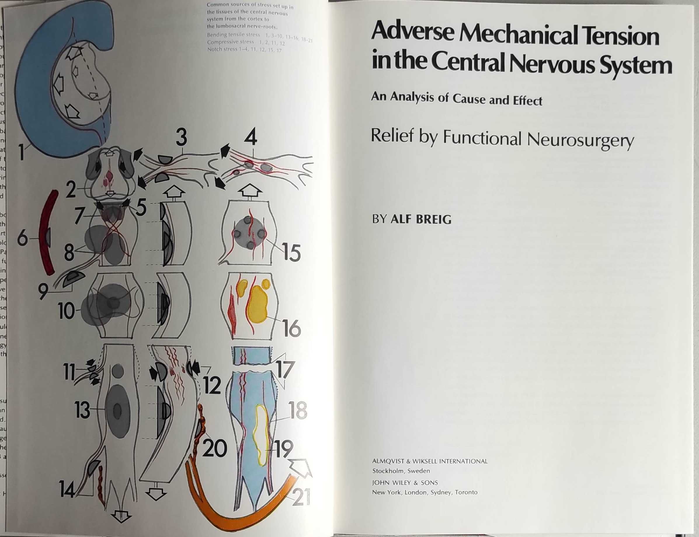 Livro - Adverse Mechanical Tension in the Central Nervous System