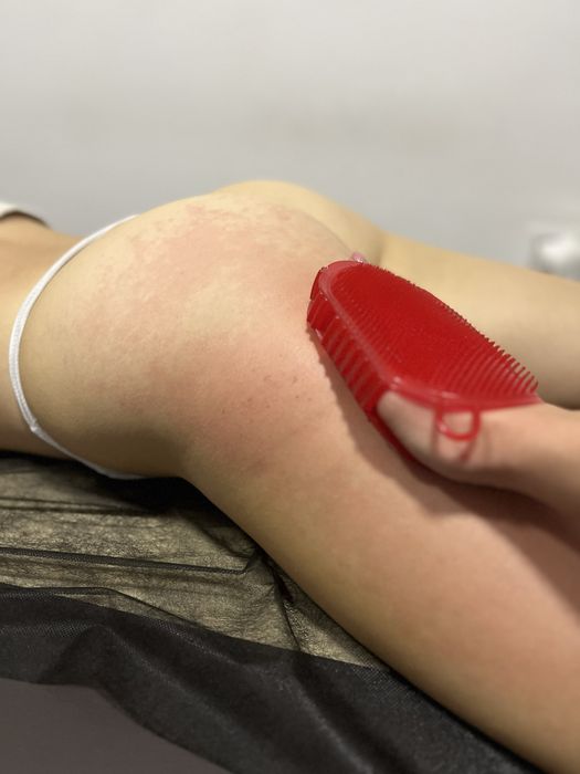 Пресотерапія, ліпопластика, лімфодренаж, кавітація  , масаж