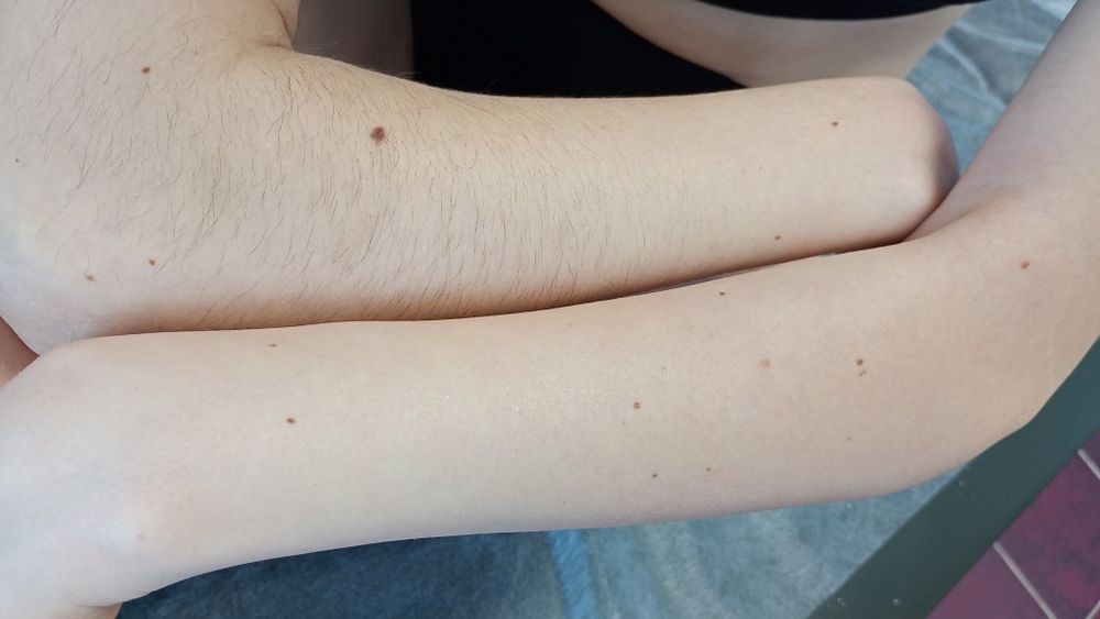 Воскова депіляція