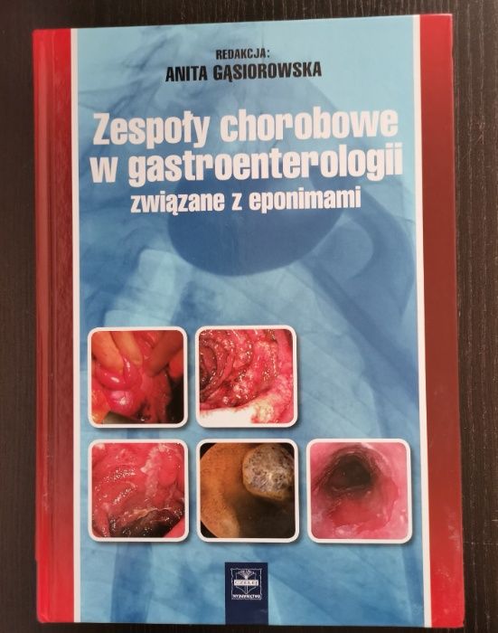 Książka "Zespoły chorobowe w gastroenterologii związane z eponimami"