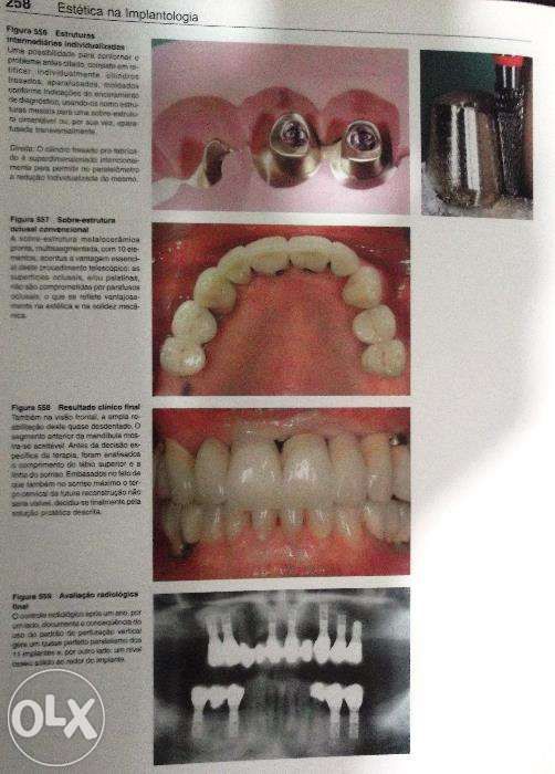 Odontologia Estetica-Atlas colorido