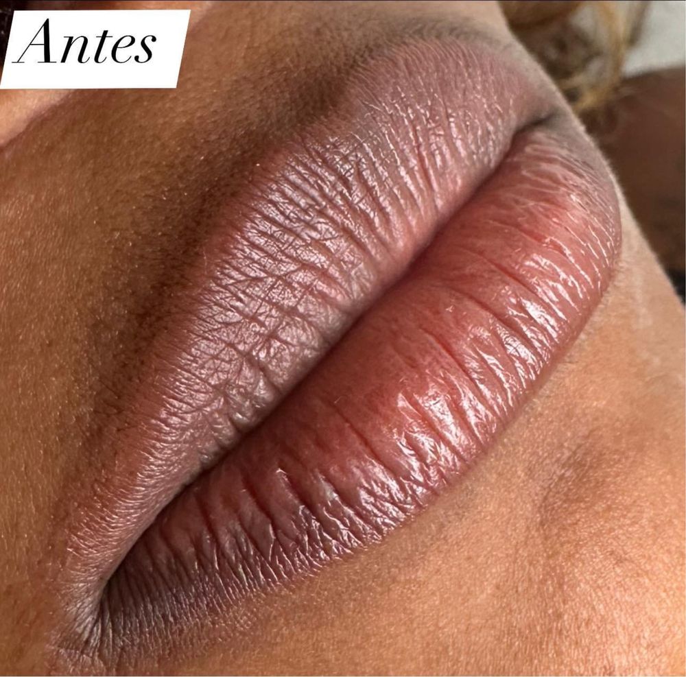 Neutralização labial