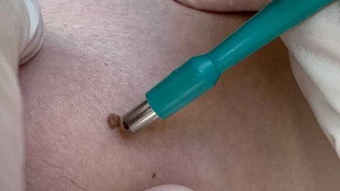 Дерматолог, дерматовенеролог, дерматоонколог