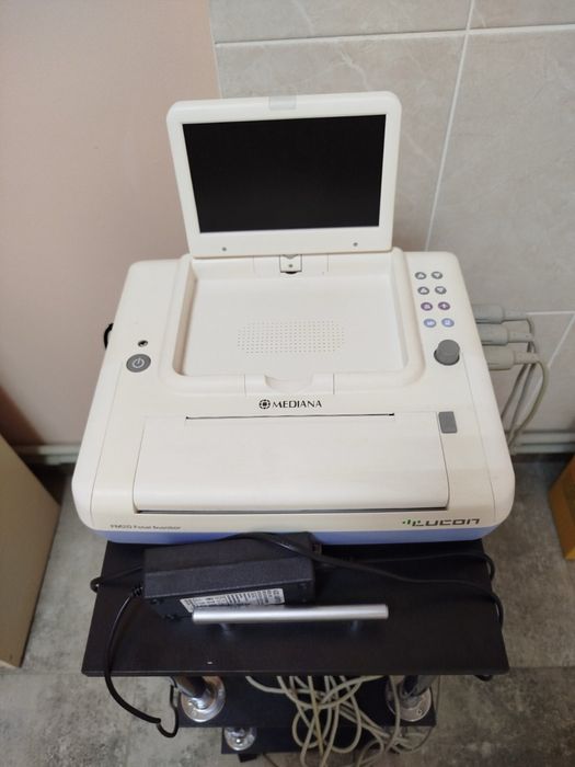 Фетальний монітор