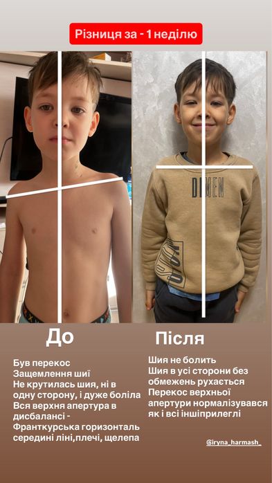 Масажист реабілітолог