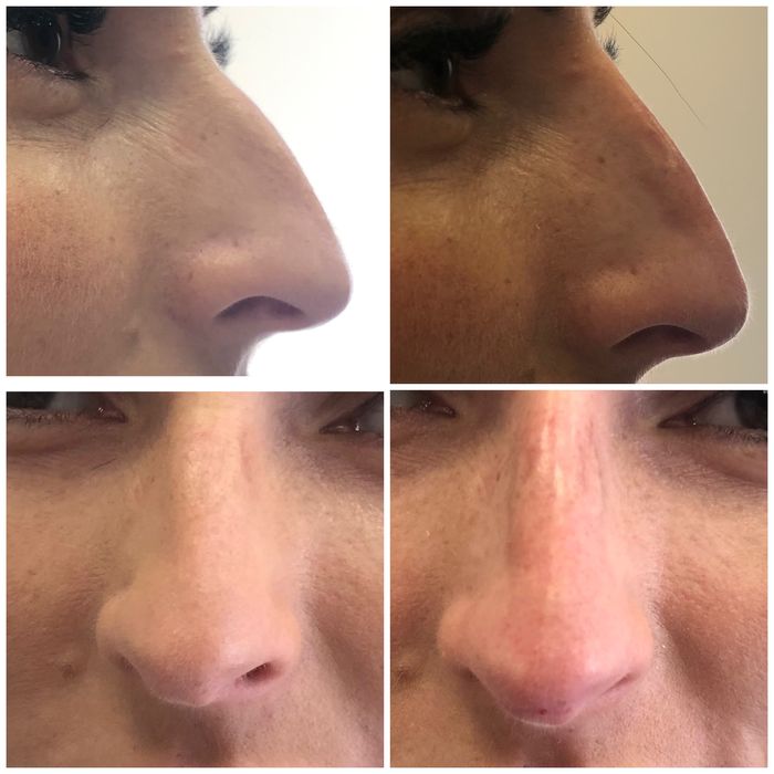 Косметолог Ужгород, інʼєкціоніст.