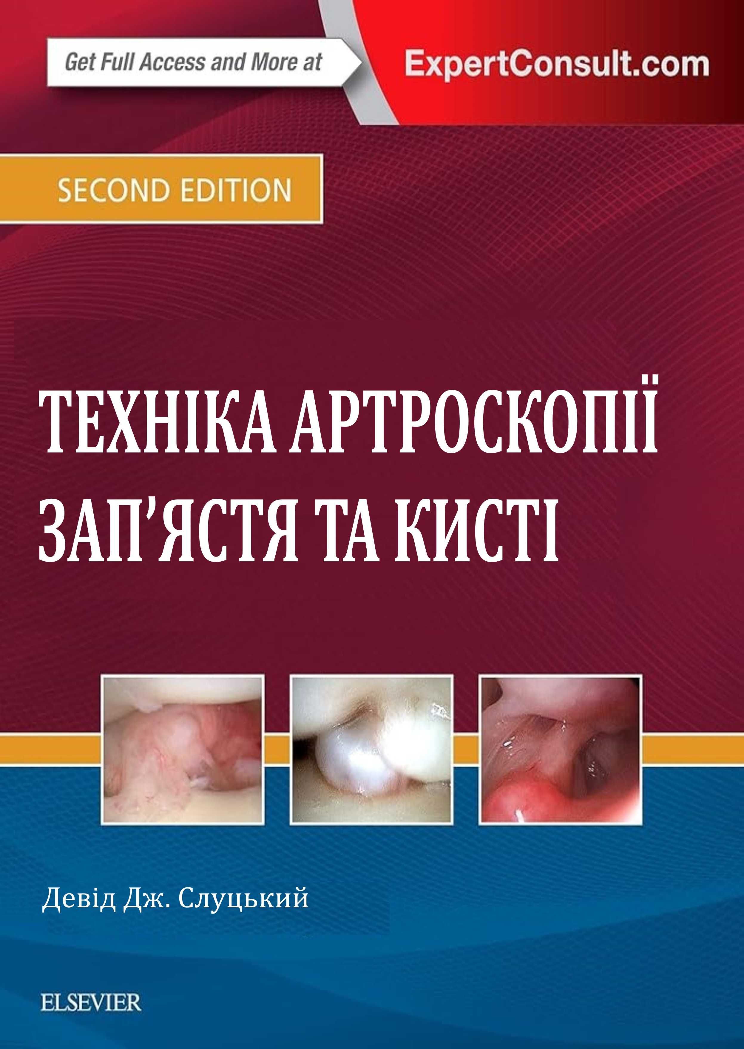 Техніка артроскопії запястя та кисті Девід Дж. Слуцький 2017 р.