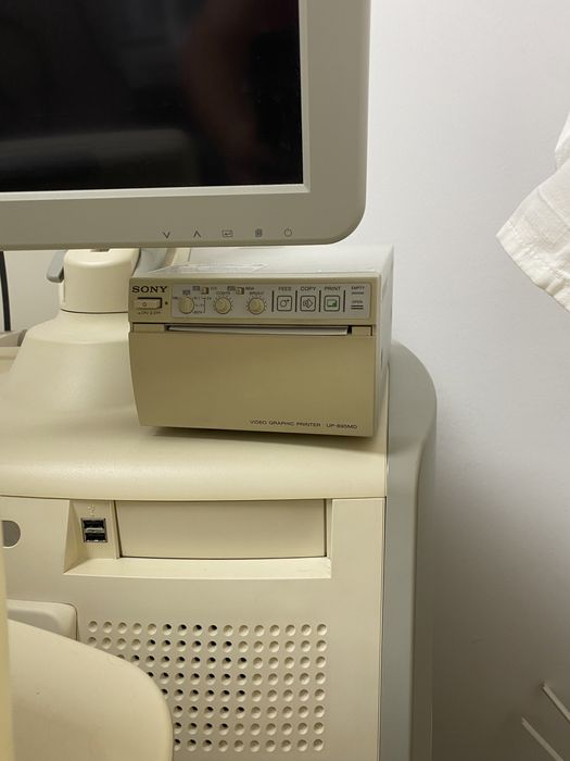 ecografo preparado para ginecologia/obste com impressora e ecram tv