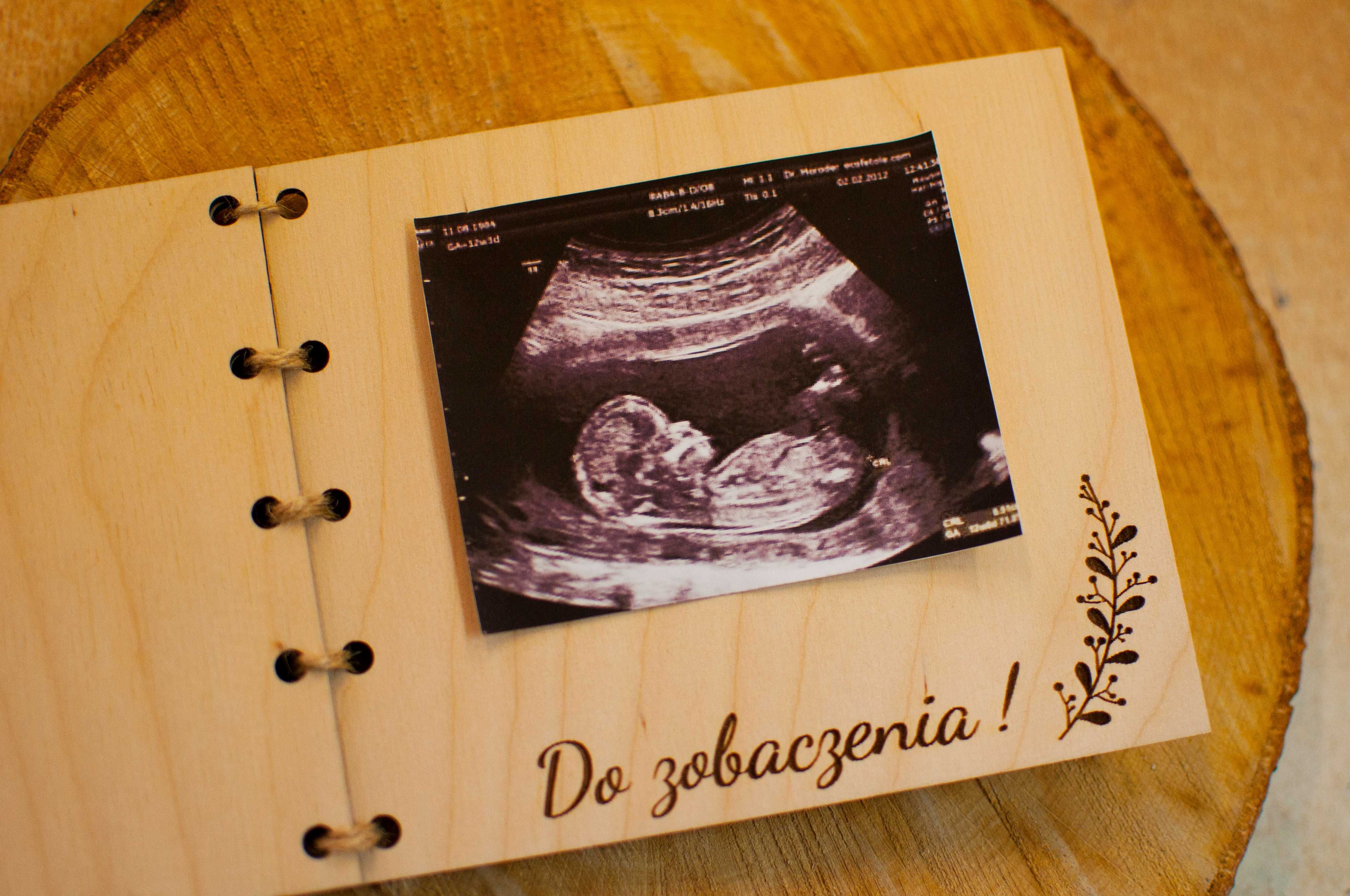 Zostaniecie Dziadkami NOWOŚĆ - informacja o ciąży grawer