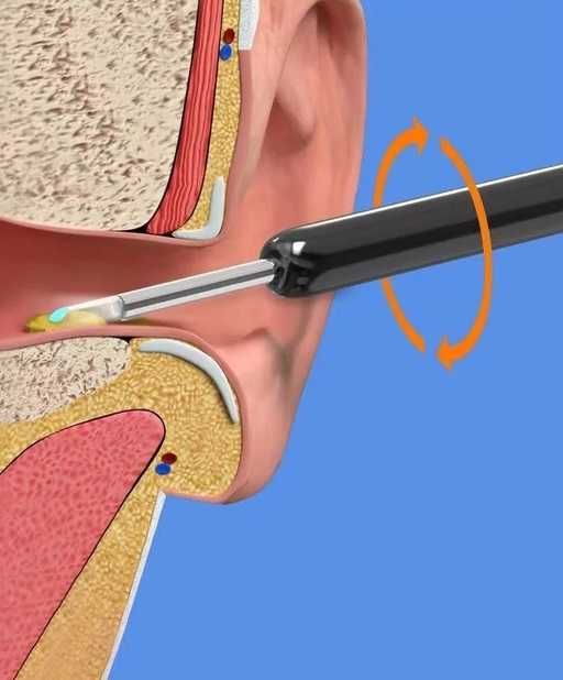 Прилад для видалення вушної сірки NE3 Wireless Visible Earpick