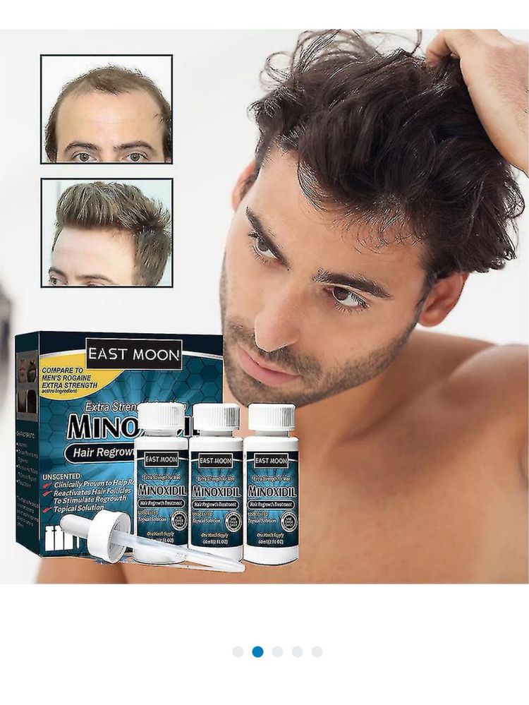 Minoxidil crescimento capilar