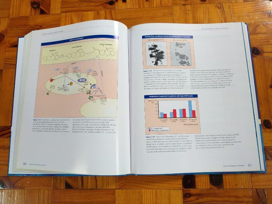 Atlas of Atherothrombosis