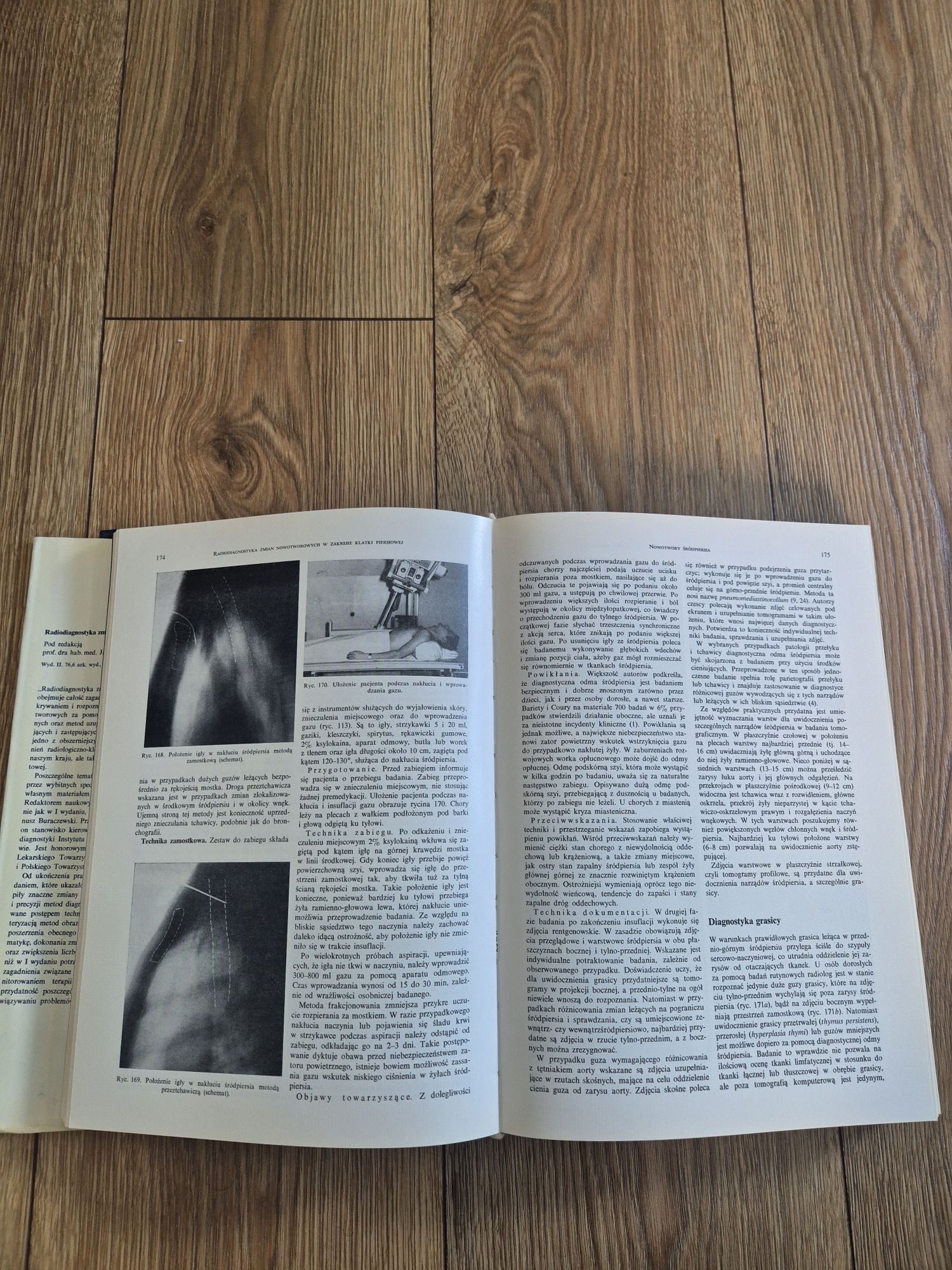 Radiodiagnostyka zmian nowotworowych