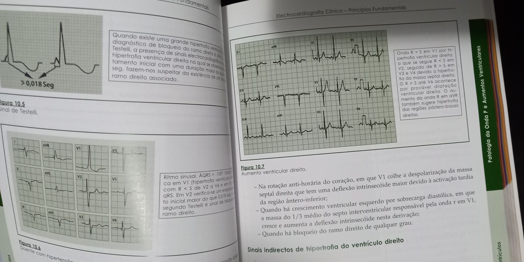 Electrocardiografia Clínica - princípios fundamentais, 2a ed