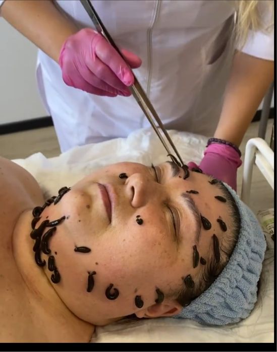 Гирудокосметология Пиявки Ксения Ангерова Мастер класс