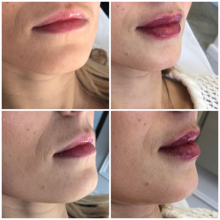 Косметолог Ужгород, інʼєкціоніст.