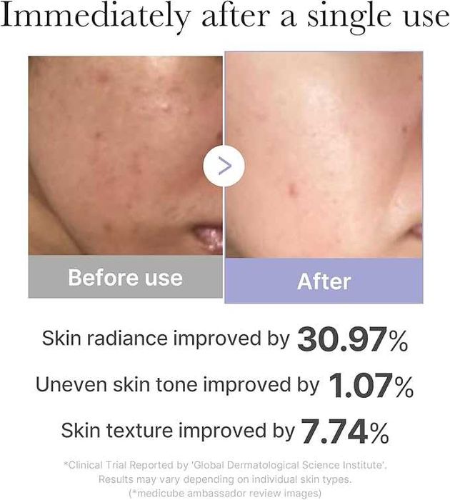 Medicube Booster Mini – пристрій для ліфтингу та омолодження шкіри