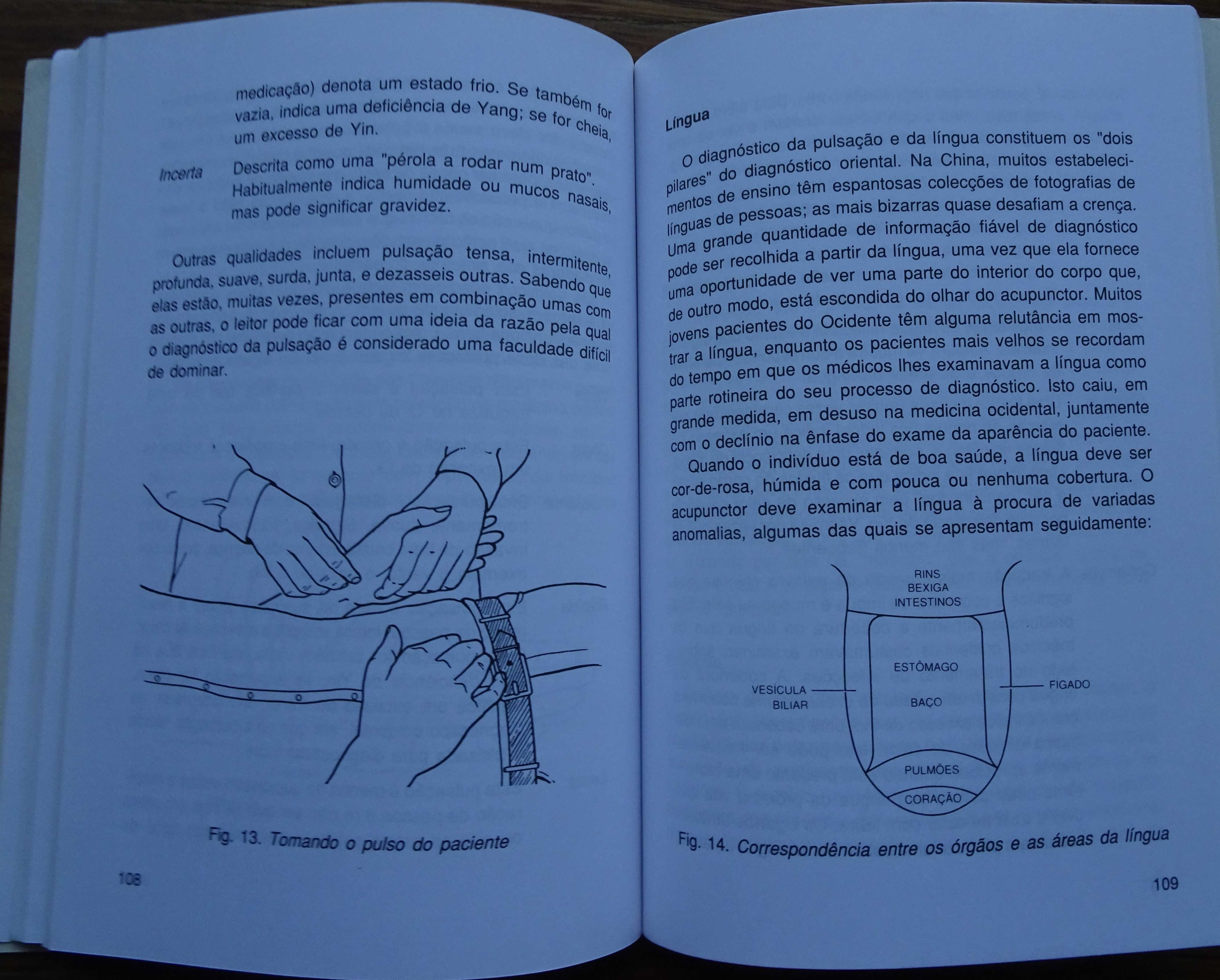 A  Acupunctura de Peter Mole