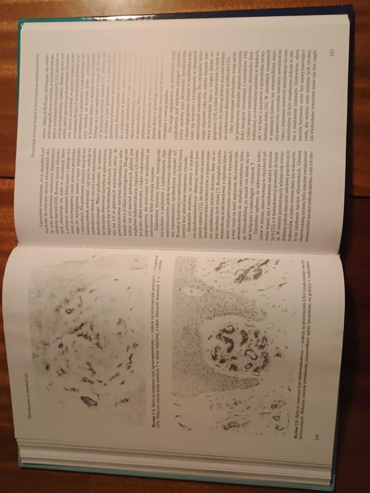 Mikrokrążenie w chorobach żył - Smith