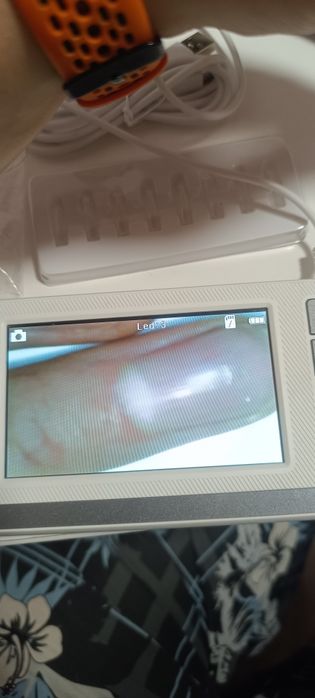 Отоскоп універсальний.