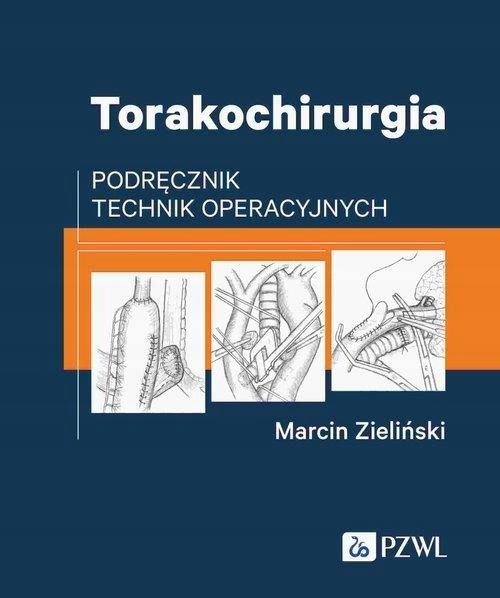 Torakochirurgia, Zieliński Marcin 82142A00218Ks