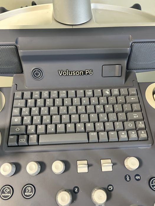 Aparat USG voluson p6