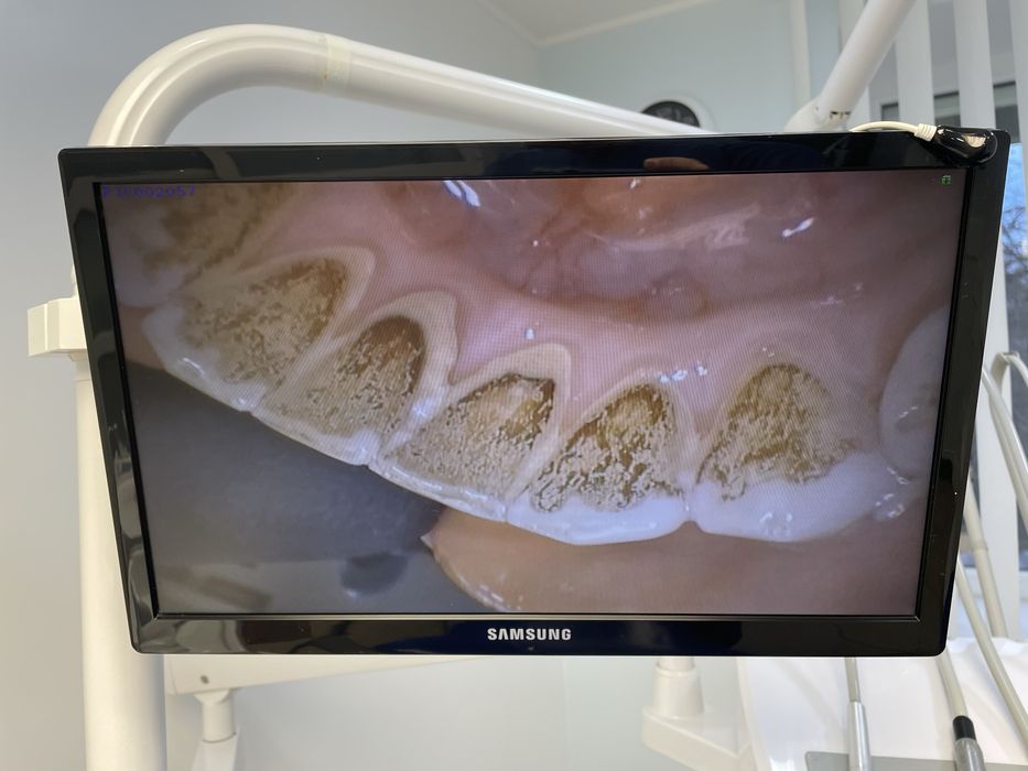 Стоматологічна установка Azimut 500B