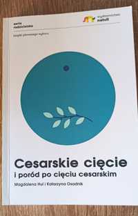 Cięcie cesarskie i poród po cięciu cesarskim