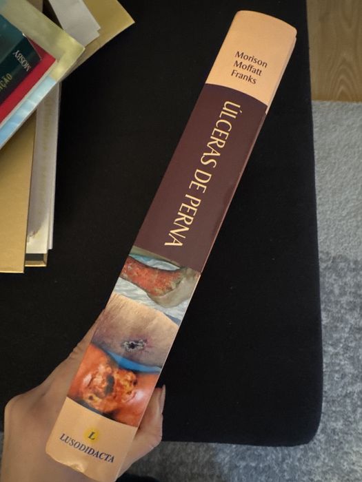 Livro Ulceras de Perna
