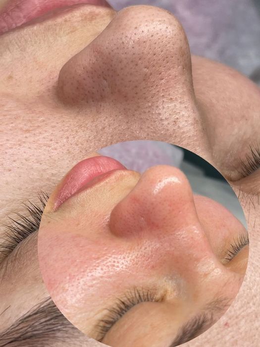 Якісна чистка обличчя  від 500