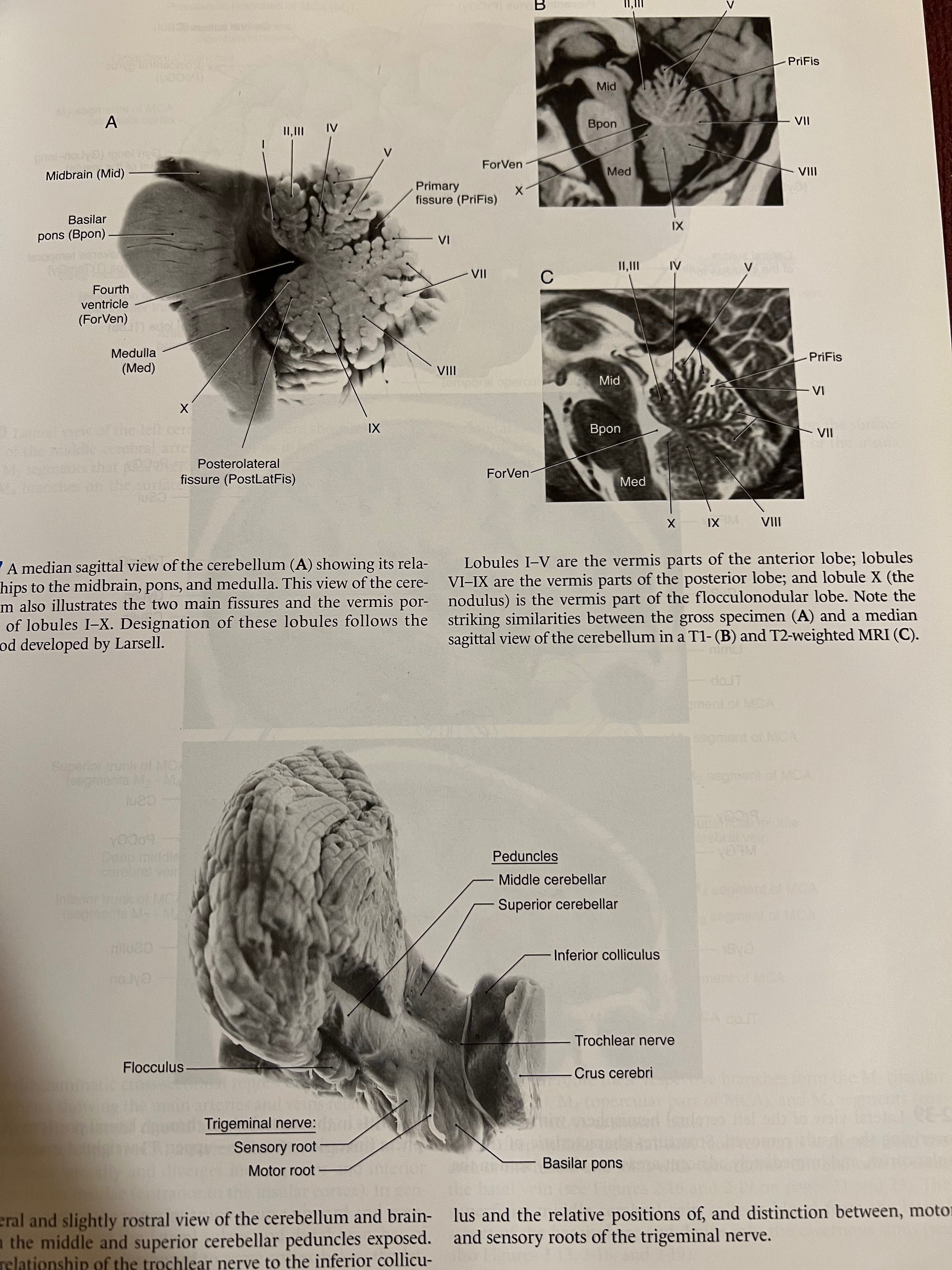 Neuroanatomy Atlas Haines