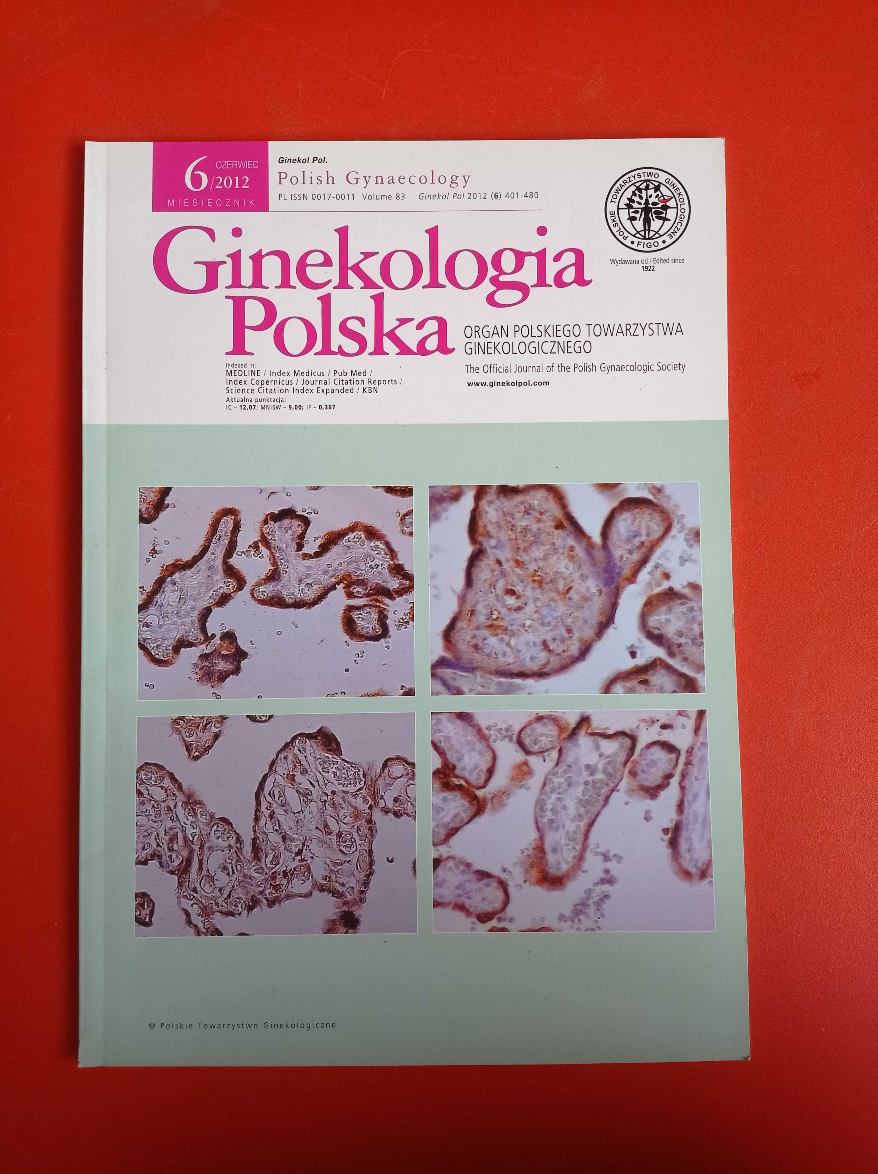 Ginekologia Polska, nr 6/2012, czerwiec 2012