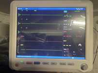 Кардіомонітор. Монітор пацієнта  Patient monitor YK-8000B